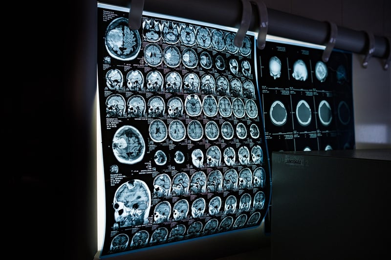 Dimensional Scanner